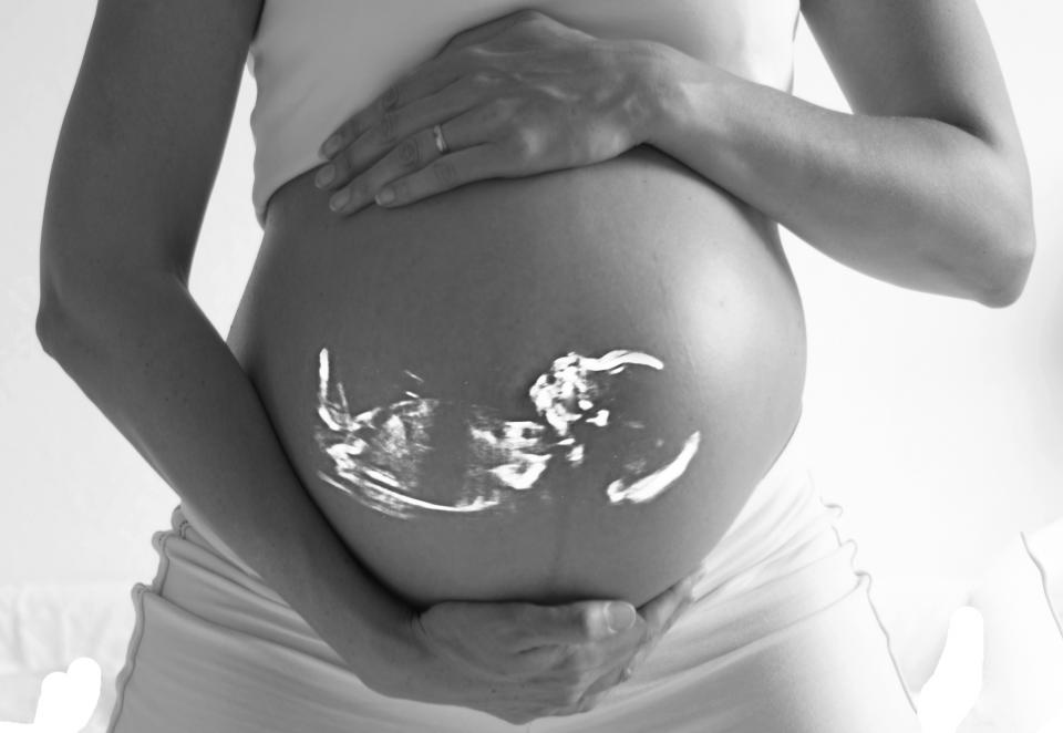 An expecting mother